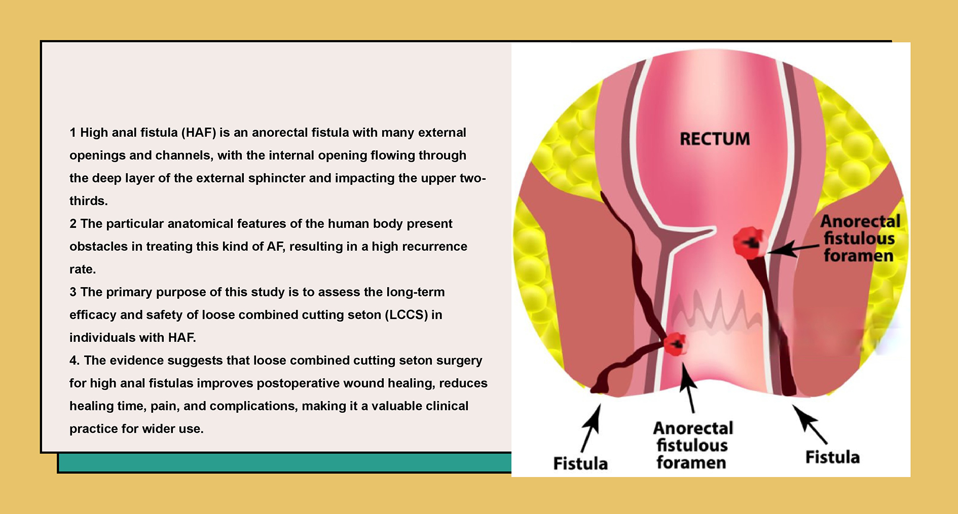 Graphical abstracts